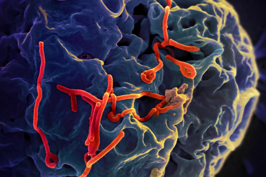 Close-up of a microbe