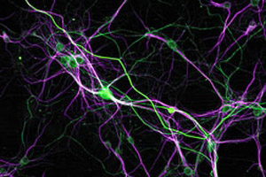 Culture of rat neurons